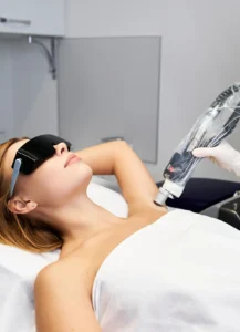 Laser_Hair_Removal